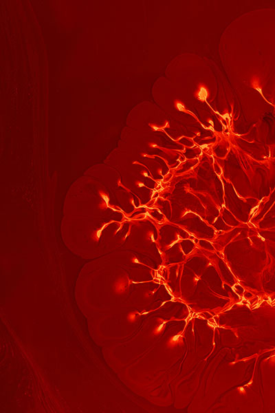 celulas inflamadas a causa de gastritis biodescodificacion